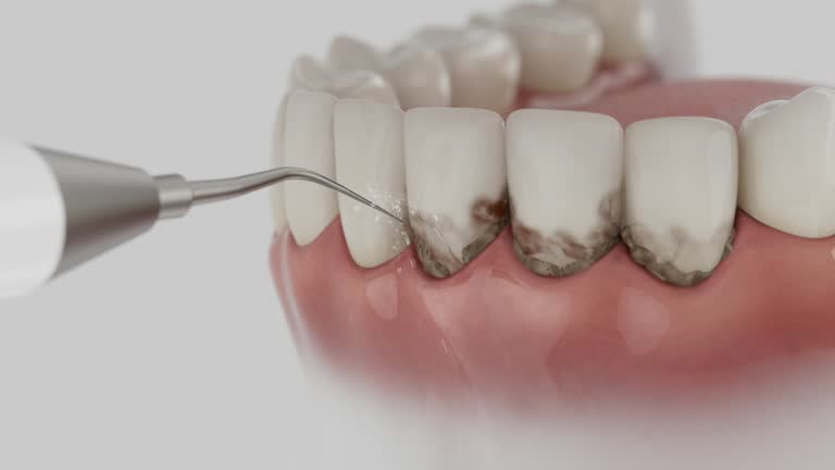Reliable Dental Implants contractor in Rutherford, TN by Smile Center Dentistry